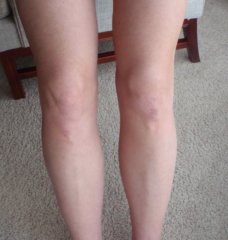 Knee comp. .. This comp is dedicated to user dennymyman