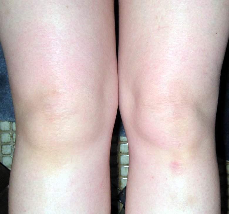 Knee comp. .. This comp is dedicated to user dennymyman