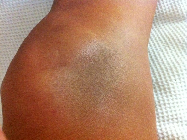 Knee comp. .. This comp is dedicated to user dennymyman