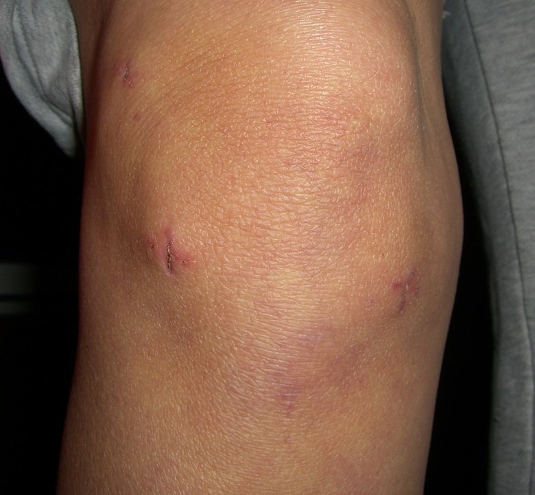 Knee comp. .. This comp is dedicated to user dennymyman